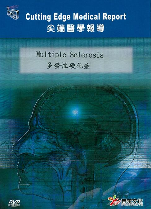 多發性硬化症 Multiple sclerosis