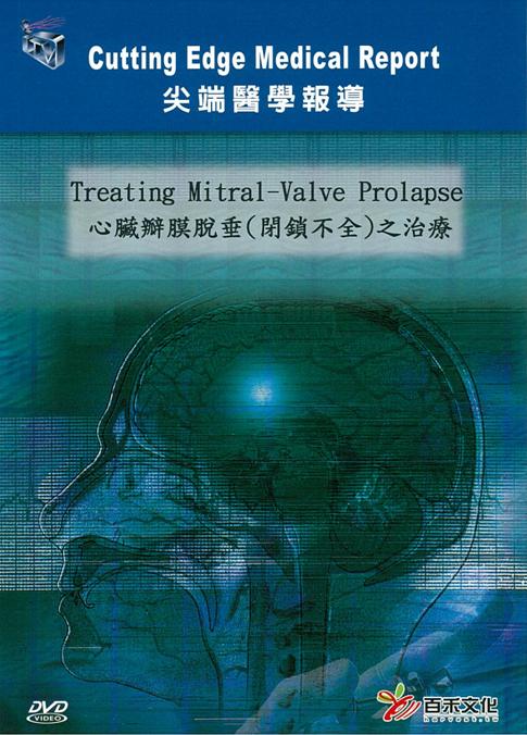 心臟瓣膜脫垂(閉鎖不全)之治療 Treating mitral-valve prolapse