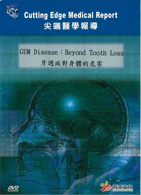 牙周病對身體的危害 GUM disease: beyond tooth loss