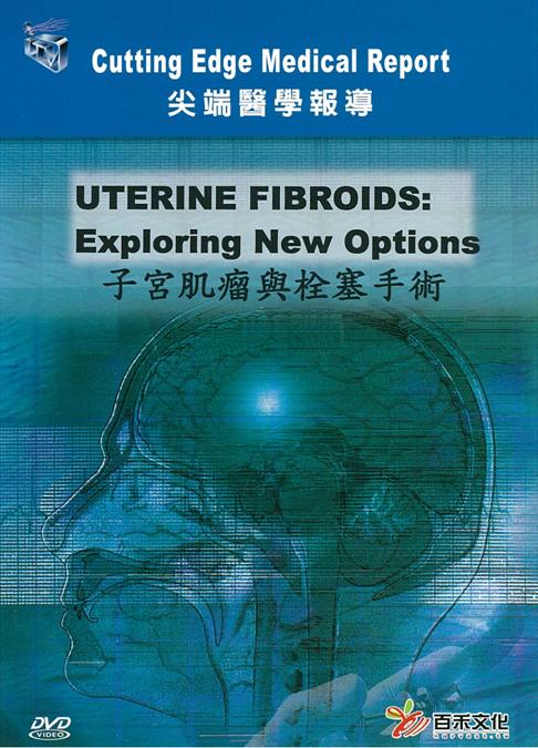 子宮肌瘤與栓塞手術 Uterine fibroids : exploring new options