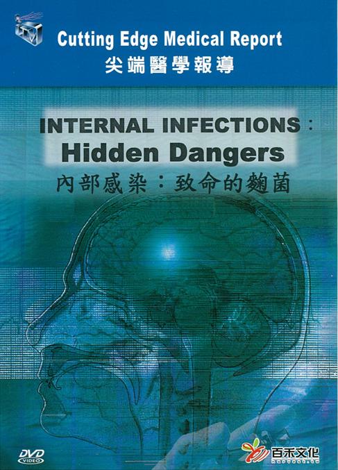 內部感染 Internal infections : hidden dangers 致命的麴菌