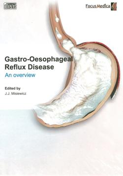 Gastro-oesophageal reflux disease an overview 胃食道逆流疾病