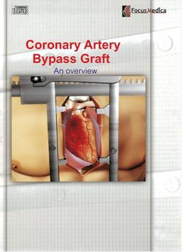 Coronary artery bypass graft an overview 冠狀動脈繞道手術