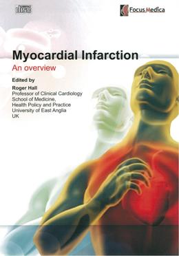 Myocardial infarction an overview 心肌梗塞