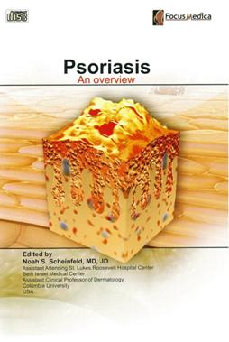 Psoriasis on overview 乾癬症