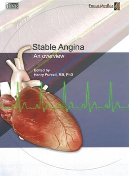 Stable angina  穩定型心絞痛 an overview