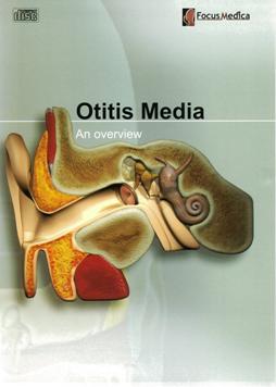 Otitis media 中耳炎 an overview