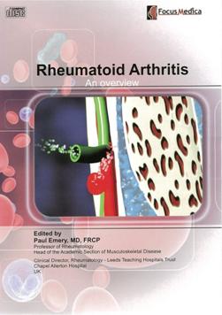 Rheumatoid arthritis 類風濕性關節炎 an overview