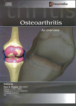 Osteoarthritis 骨性關節炎 an overview