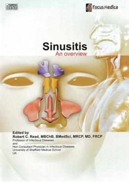 Sinusitis 鼻竇炎 an overview