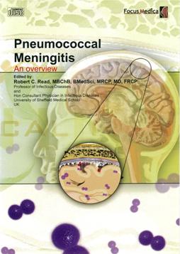 Pneumococcal meningitis 肺炎鏈球菌腦膜炎 an overview