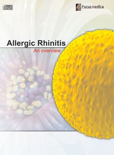 Allergic rhinitis 過敏性鼻炎 an overview