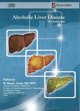 Alcoholic liver disease an overview