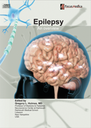 Epilepsy an overview