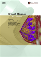 Breast cancer an overview