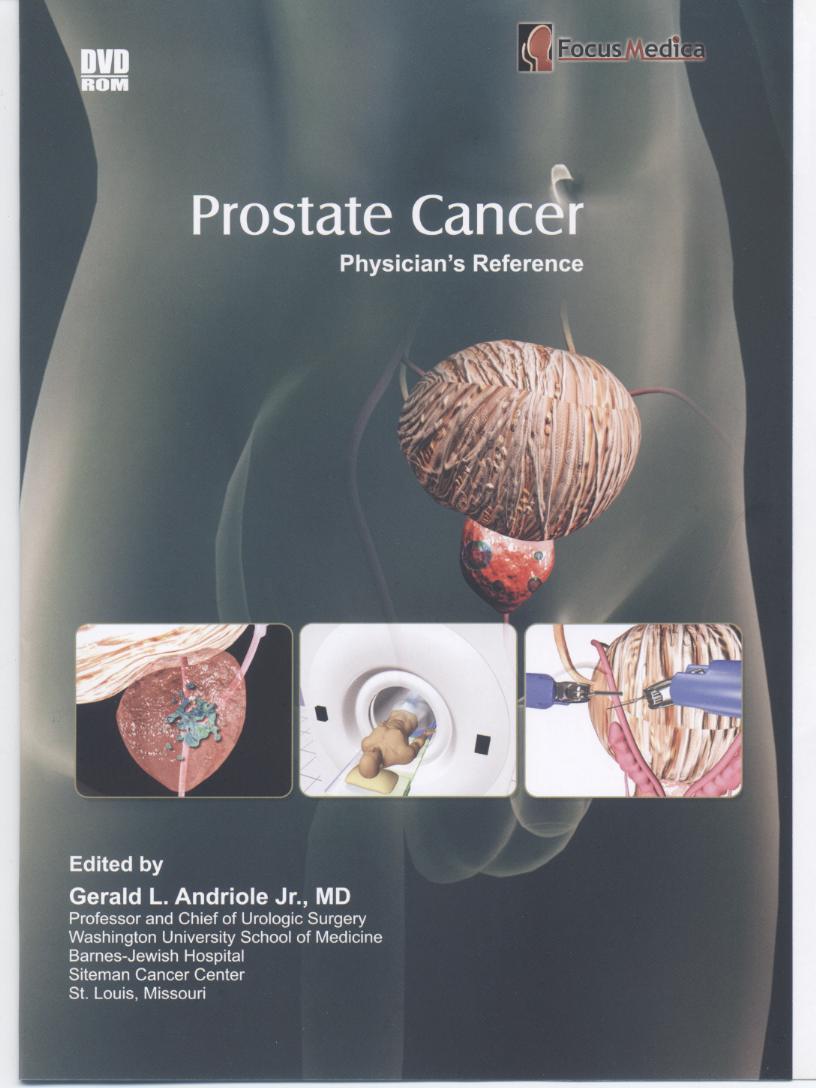 Prostate cancer physician