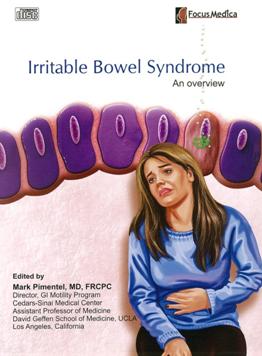 Irritable bowel syndrome an overview