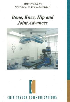 Bone- Knee- Hip and joint advances 先進的科學與技術系列：健康與醫學 - 先進科技－骨頭，膝蓋，臀部和關節醫療