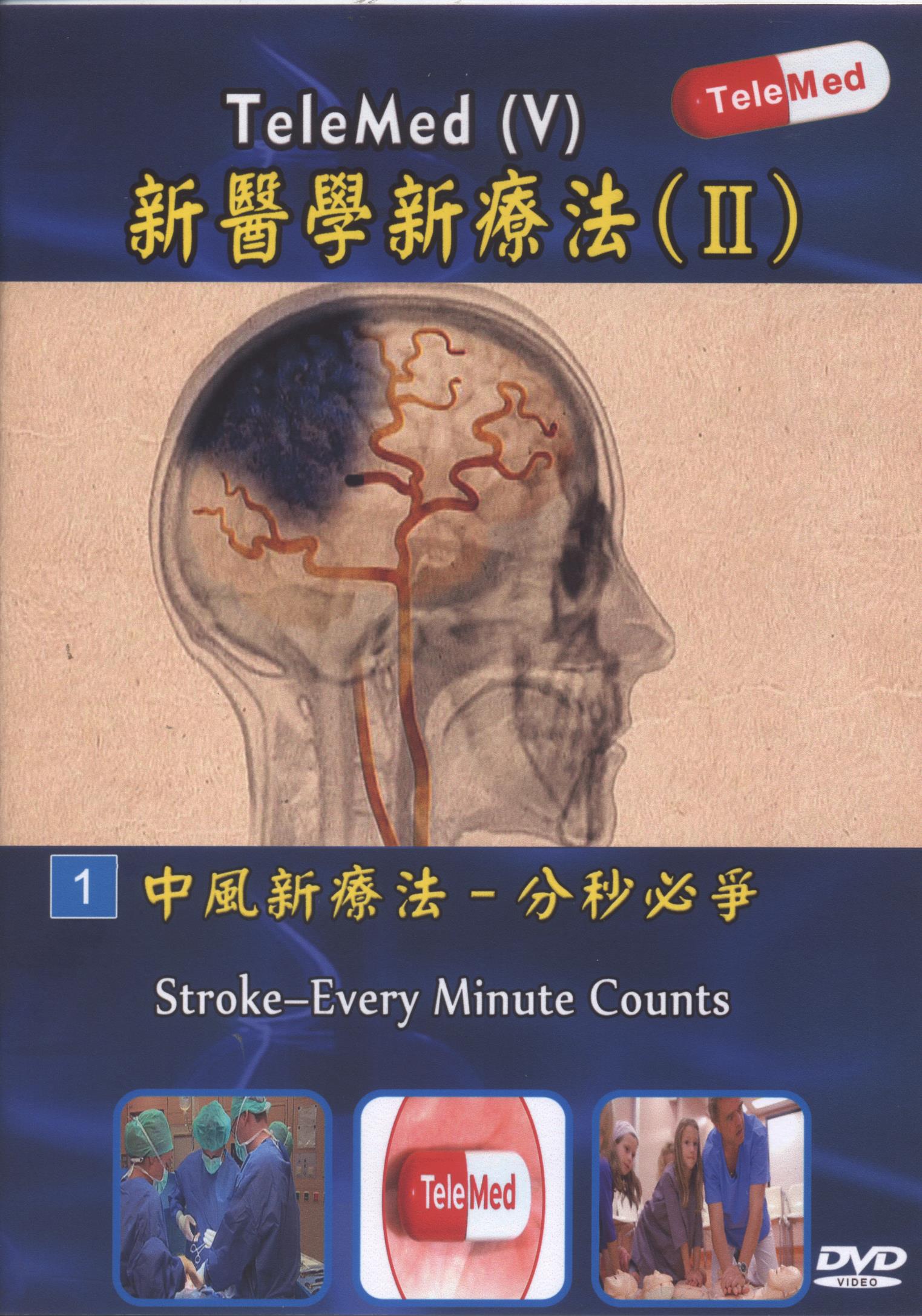 中風新療法 : 分秒必爭 = Stroke : every minute counts.