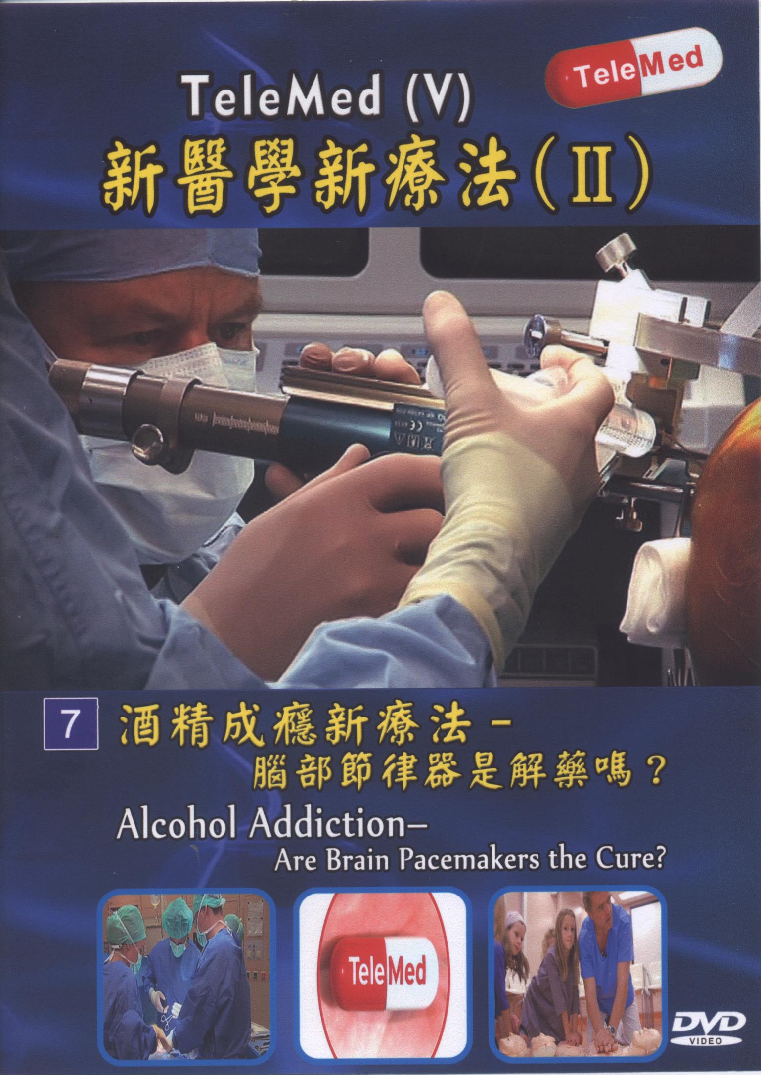 酒精成癮新療法 : 腦部節律器是解藥嗎？ = Alcohol addiction : are brain pacemakers the cure?