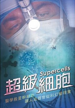 超級細胞 : Supercells